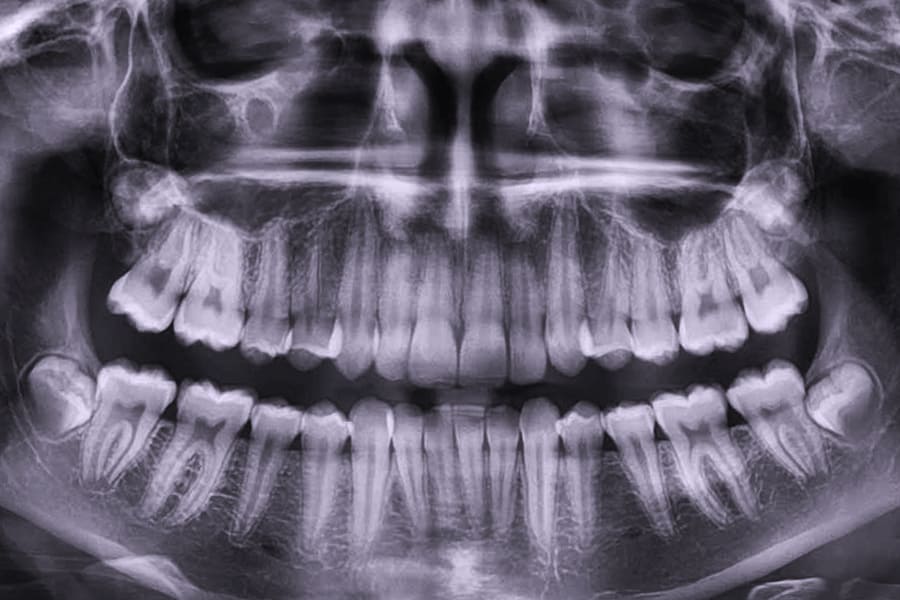 Выбирайте качественные рентген аппараты для стоматологии